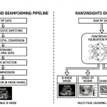초음파가 '들리는' 순간: AI 가 의료 영상의 경계를 허물다