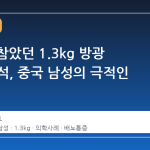 3 년간 참았던 1.3kg 방광 거대 결석, 중국 남성의 극적인 발견