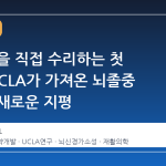 뇌 손상을 직접 수리하는 첫 약물, UCLA가 가져온 뇌졸중 재활의 새로운 지평