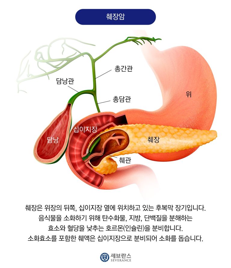 췌장암 치료에서 발견된 '암의 마스터 스위치', 왜 지금 주목받는가