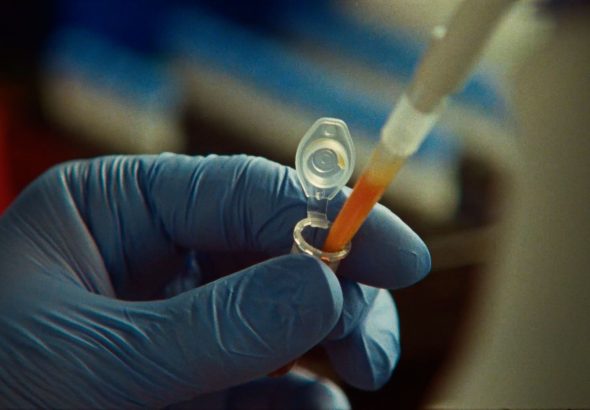 앤트로픽, AI 에이전트로 CRISPR 유사 반복 서열 가진 신규 효소 시스템 발견